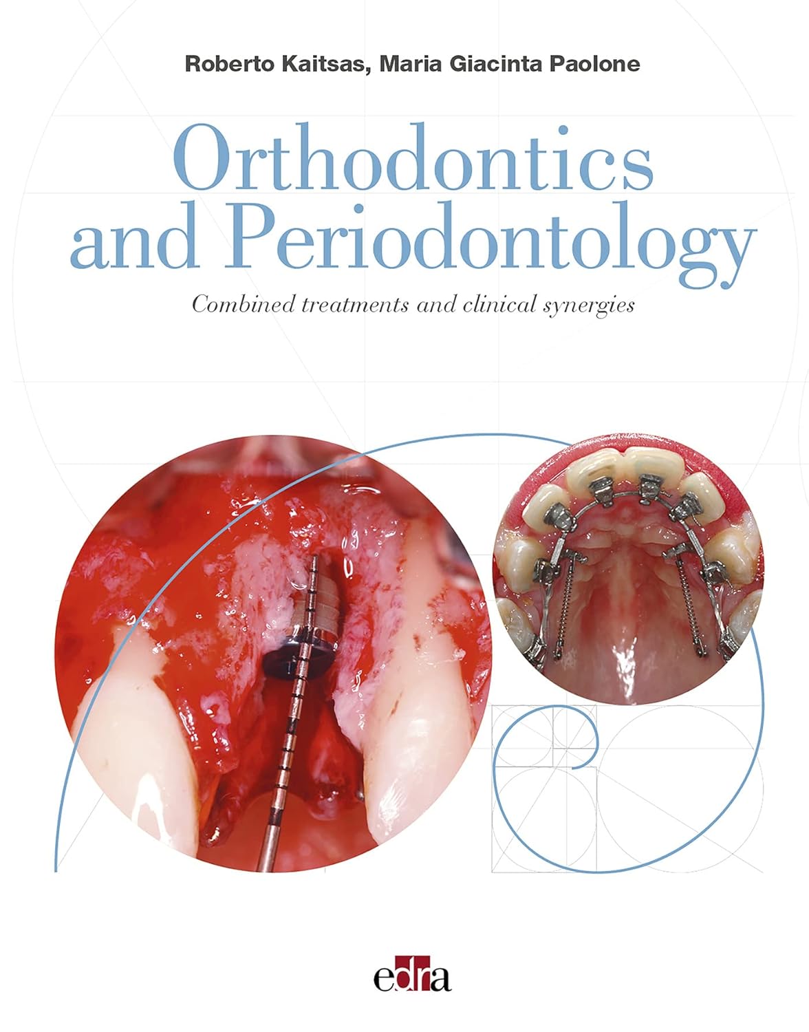 Orthodontics and periodontology: combined treatments and clinical synergies