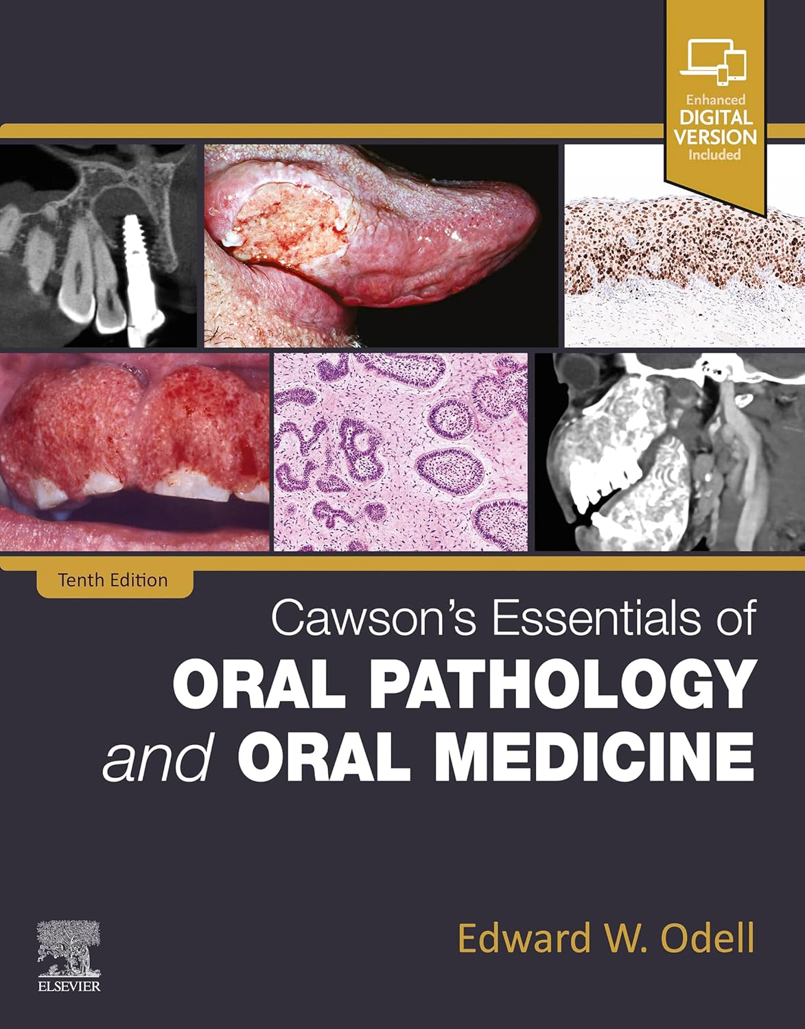 Cawson's essentials of oral pathology and oral medicine