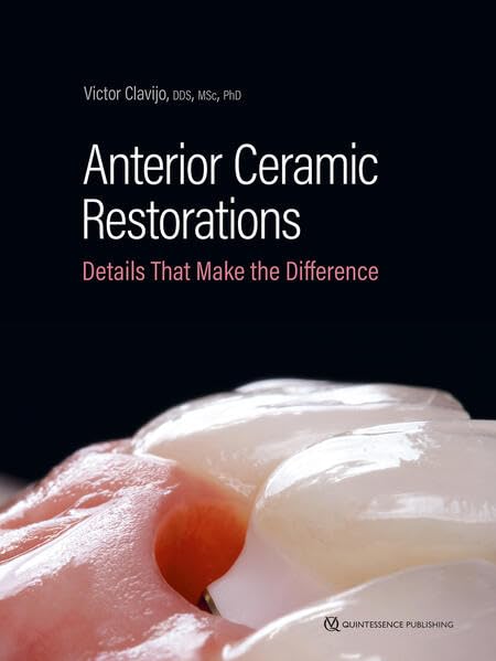 Anterior ceramic restorations details that make the difference