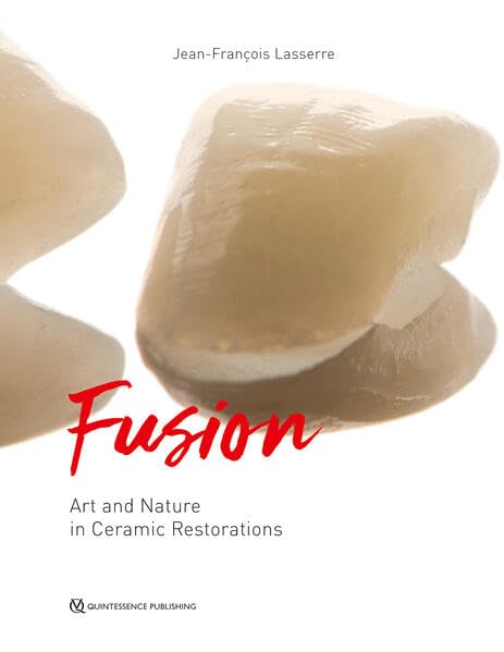 	Fusion art and nature in ceramic restorations 