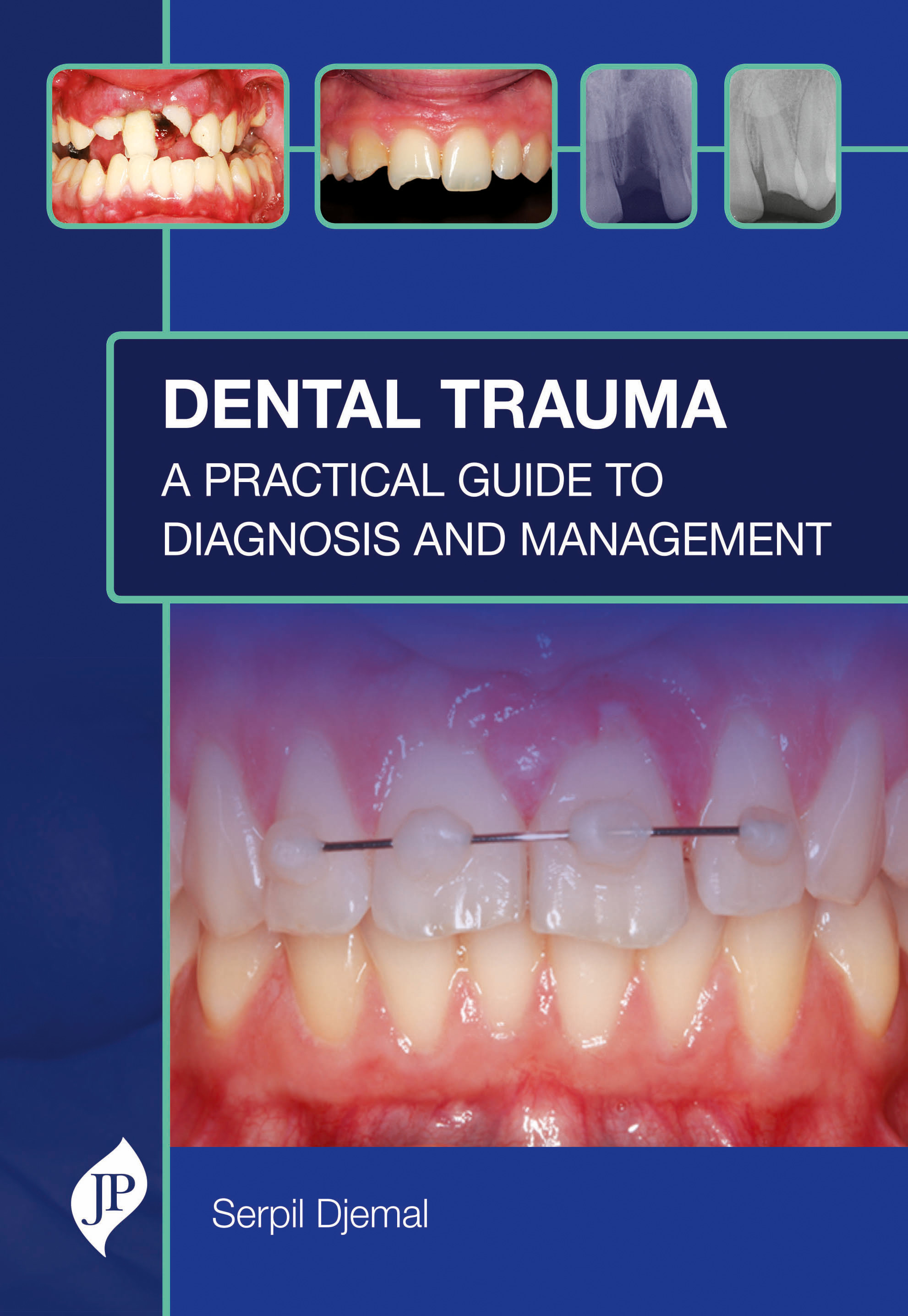 Dental trauma: a practical guide to diagnosis and management